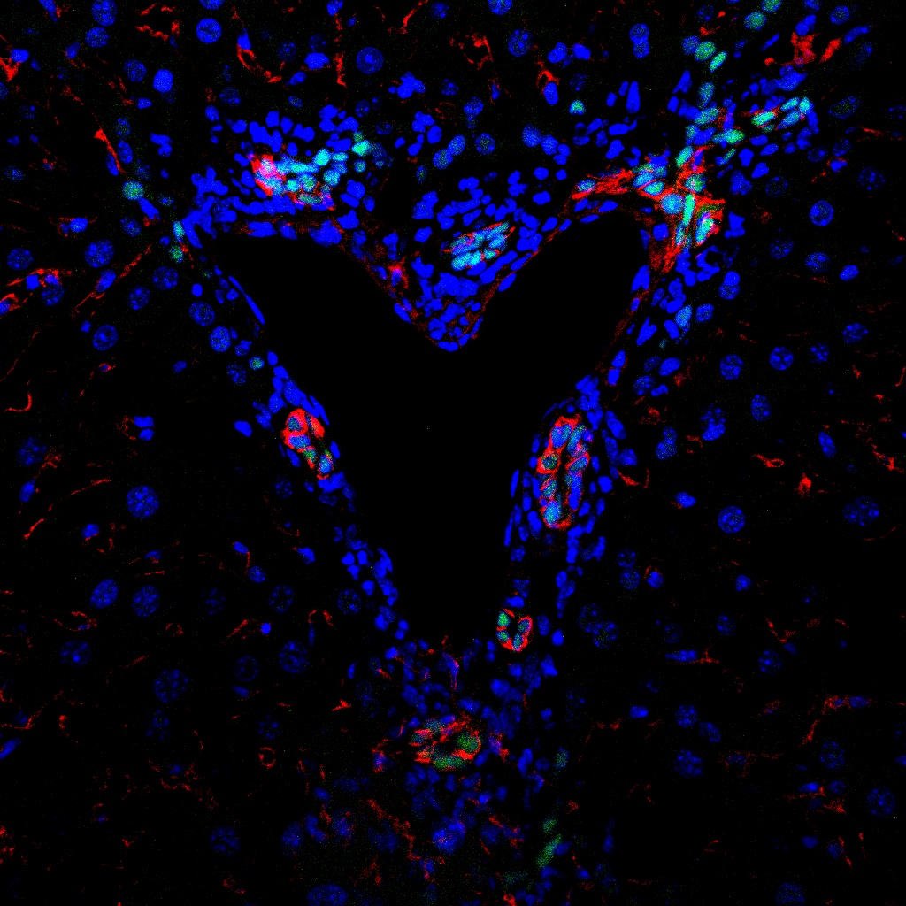 Love progenitors cells
